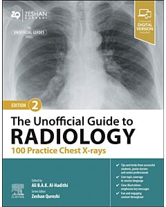 The Unofficial Guide to Radiology: 100 Practice Chest X-rays
