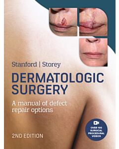 Dermatologic Surgery