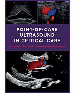 Point-of-Care Ultrasound in Critical Care