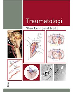 Traumatologi