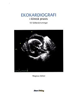 Ekokardiografi i klinisk praxis: 55 fallbeskrivningar