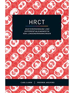HRCT : mustererkennung und Differentialdiagnostik von Lungenerkrankungen